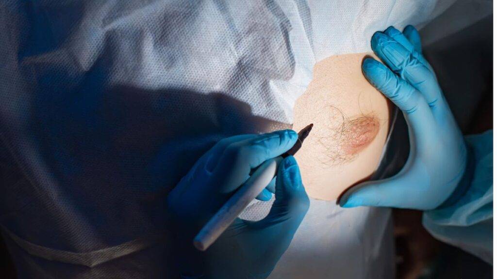 Plastische Chirurgie Bochum: Informationen zur Fettabsaugung und Bauchdeckenstraffung